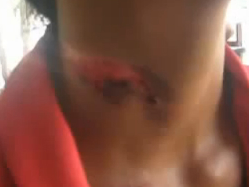 neck