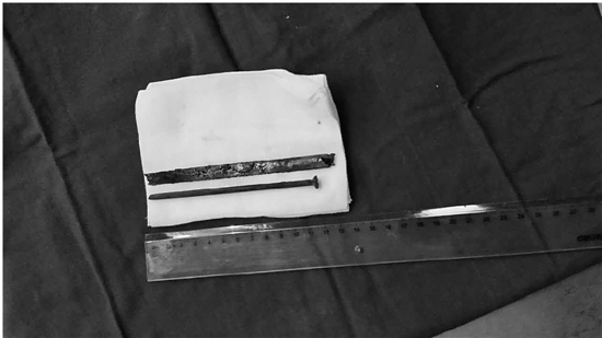 FOREIGN201512031011000378970523914