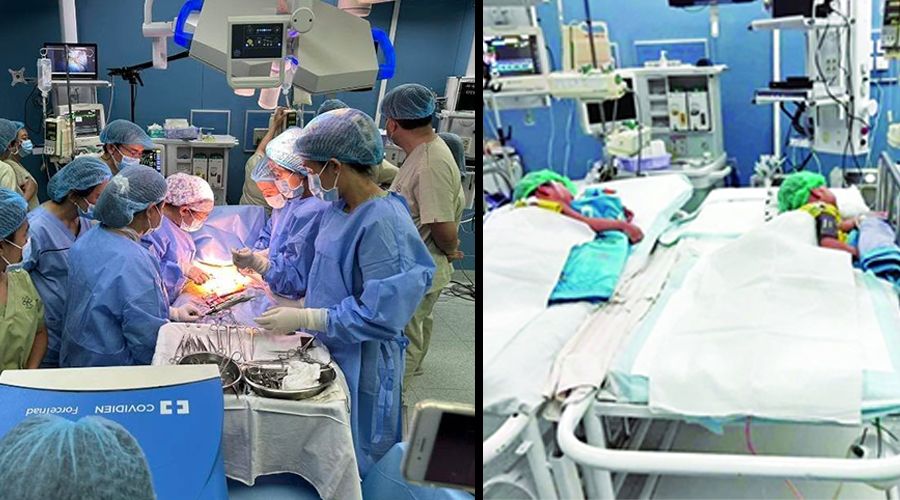 ရန်ကုန် ကလေးဆေးရုံကြီးတွင် ရင်ချင်းဆက်အမြွှာမိန်းကလေး ခွဲစိတ်ကုသမှု အောင်မြင်