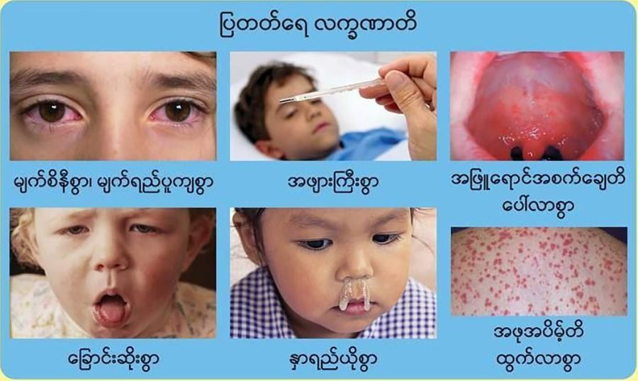 ဘင်္ဂလားဒေ့ရှ်နှင့် ထိစပ်နေသည့် မြို့နယ်များတွင် ဝက်သက်ရောဂါ အထူးသတိပြုရန် AA တိုက်တွန်း
