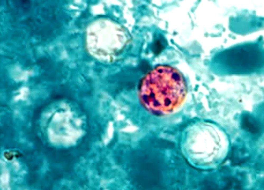 Photo: REUTERS / CDC / OREGON STATE PUBLIC HEALTH LABORATORY