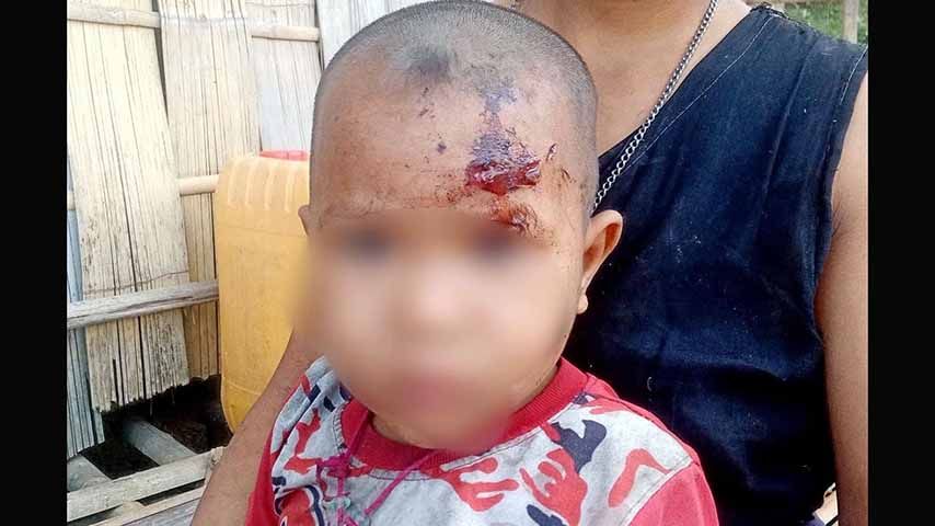 ဘူးသီးတောင်ကို စစ်တပ်က ဗုံးထပ်ကြဲ၊ ၁ ဦးသေပြီး ၅ ဦးဒဏ်ရာရ