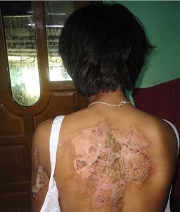 housekeeper abuse
