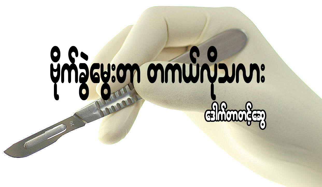 ဗိုက္ခြဲေမြးတာ တကယ္လိုသလား