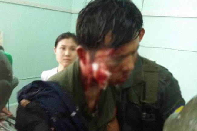 အစုိးရတပ္ ေကာ့ကရိတ္ၿမိဳ႕နယ္တြင္း နယ္ေျမရွင္းစဥ္ ေခ်ာင္းပစ္ခံရ၊ ၂ ဦး ဒဏ္ရာရ