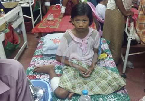 ေက်ာက္ျဖဴၿမိဳ႕တြင္ တရက္ထဲ လူ ၁၃ ဦး  ေခြး႐ူးအကိုက္ခံရ