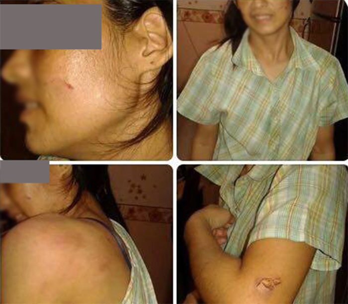 ထုိင္းတြင္ အိမ္အကူ ျမန္မာအမ်ဳိးသမီးတဦး လုပ္ခမရဘဲ ႏွိပ္စက္ခံရ