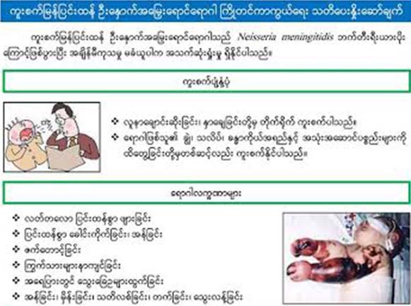 ကူးစက္ျမန္ဦးေႏွာက္အေျမႇးေရာင္ေရာဂါျဖင့္ေသဆံုးသည့္ ကေလးငယ္ ၁၀ ဦးရွိၿပီ