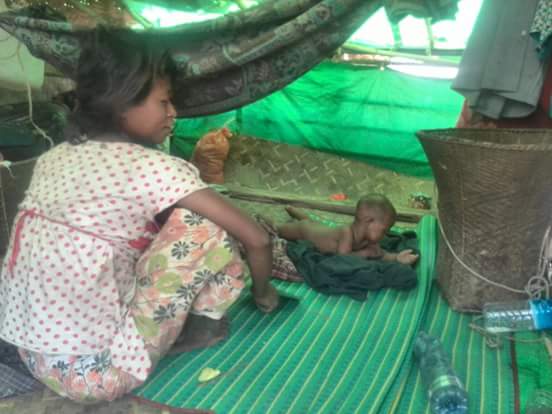 ရခိုင္စစ္ေရွာင္ဒုကၡသည္စခန္းအခ်ဳိ႕တြင္ ဝမ္းပ်က္၀မ္းေလွ်ာျဖစ္၊  ေသဆုံးသူ ၂ ဦးရွိၿပီ