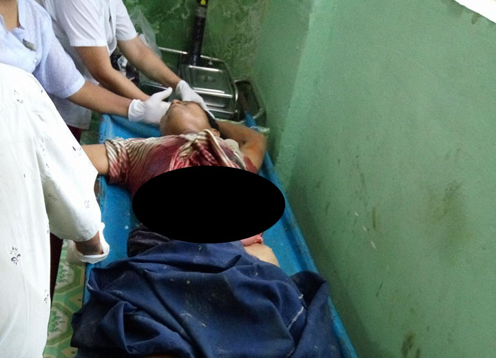 ေတာင္တြင္းႀကီးၿမိဳ႕၌ ဂတ္စ္အိုးေပါက္ကြဲ၊ လူ ၁ ဦး ဗိုက္ပြင့္ထြက္ ဒဏ္ရာရ