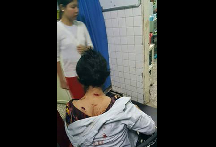 စမ္းေခ်ာင္းအမတ္ေနအိမ္ ေဖာက္ထြင္းသူက အဘြားအုိကုိ ဓားျဖင့္ ၃ ခ်က္ထုိး