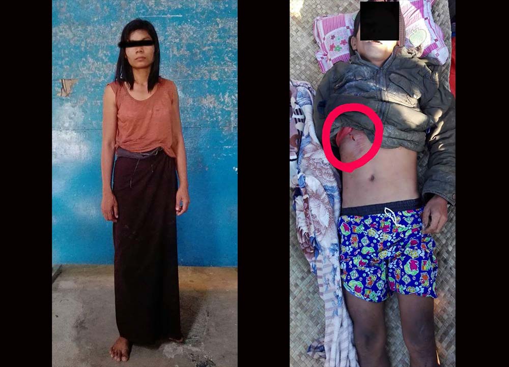 လင္မယားခ်င္း စကားမ်ားရာမွ ခင္ပြန္းျဖစ္သူကို ကတ္ေၾကးျဖင့္ ထိုးသတ္
