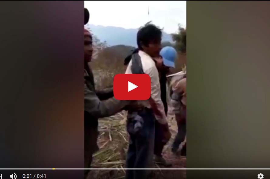 လက္​နက္​ႀကီးထိမွန္ခဲ့သည့္  ျမန္​မာႏိုင္​ငံသား တ႐ုတ္​ႏိုင္ငံ၌ ေဆးကုသမႈခံရယူ (႐ုပ္သံ)
