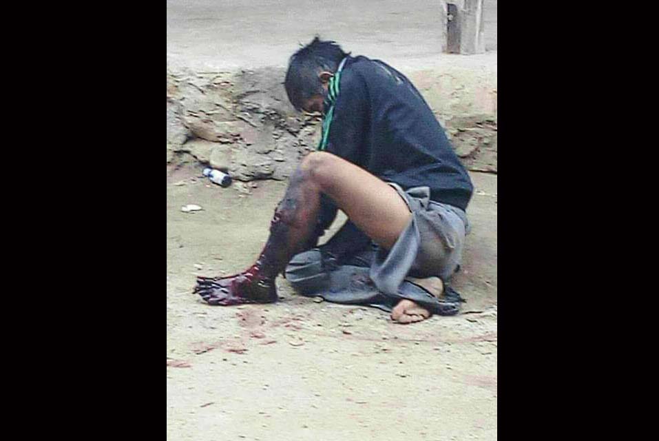 မူဆယ္တြင္ လက္လုပ္မိုင္း ၁ လံုး ေပါက္ကြဲ