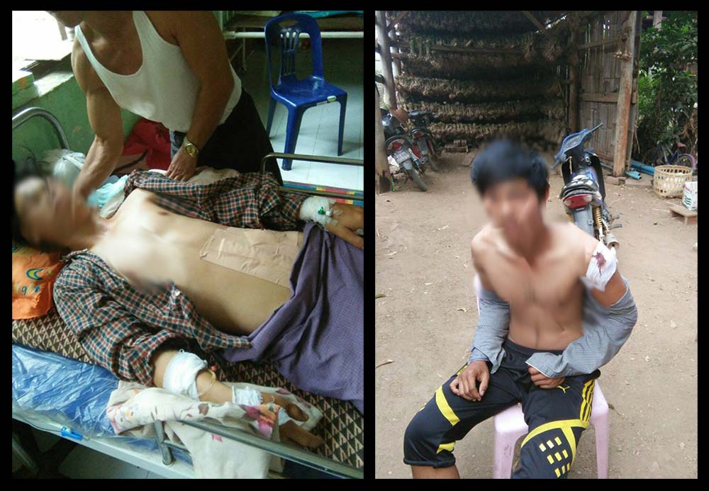 စင္ျမင့္ေရွ႕တြင္ ကခုန္ရင္းထိခိုက္မိရာမွ အုပ္စုလိုက္ ခိုက္ရန္ျဖစ္၊ ဓားထိုးခံရ