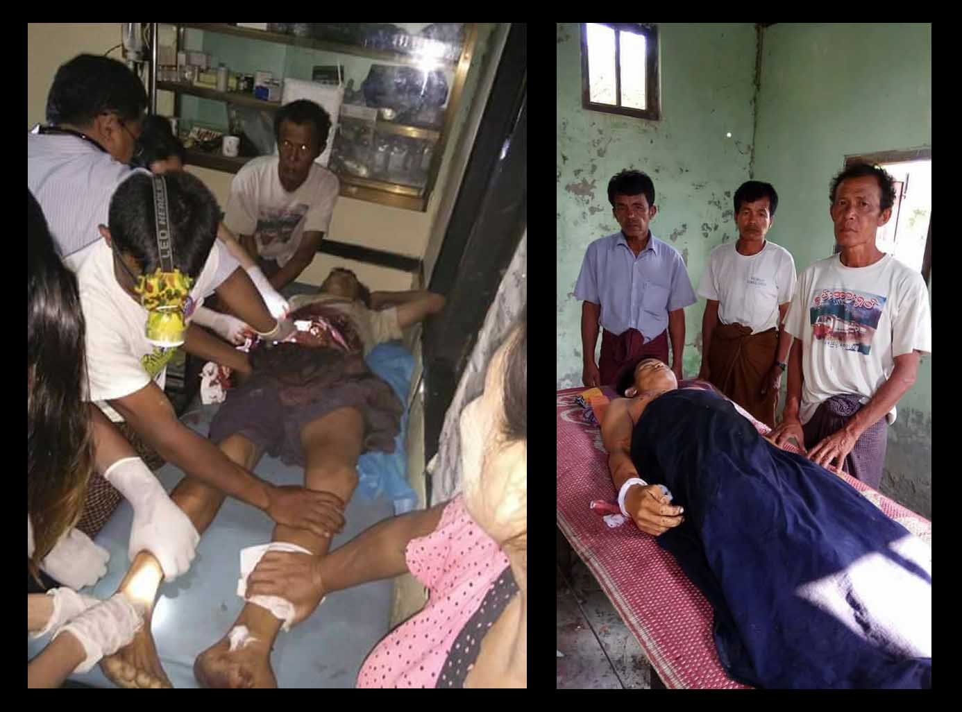 ေပါက္ေတာၿမိဳ႕နယ္တြင္ အရပ္သား ၁ ဦး ေသနတ္ပစ္ခံရ