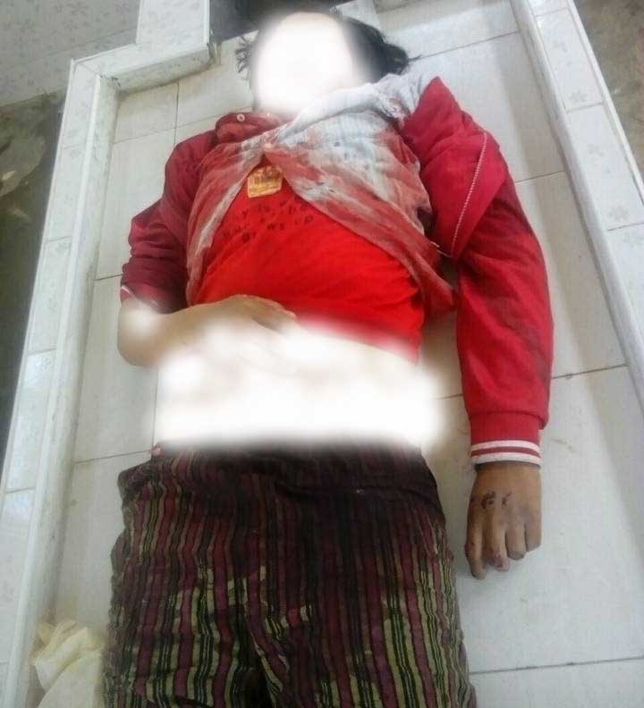 ေမာ္လူးတြင္ ဆိုင္ကယ္ႏွင့္ကား မ်က္ႏွာခ်င္းဆိုင္တိုက္၊ ၁ ဦးေသဆံုး ၁ ဦးဒဏ္ရာရ
