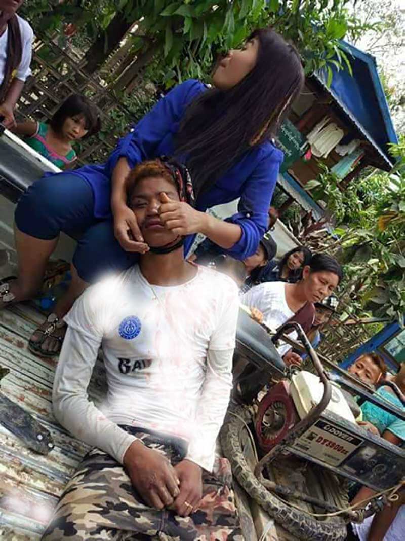 ေျမာက္ဦး ခမရတပ္သားမ်ားႏွင့္ ခိုက္ရန္ျဖစ္ပြားမႈ ဒဏ္ရာရ လူငယ္ ၃ ဦးက အမႈဖြင့္
