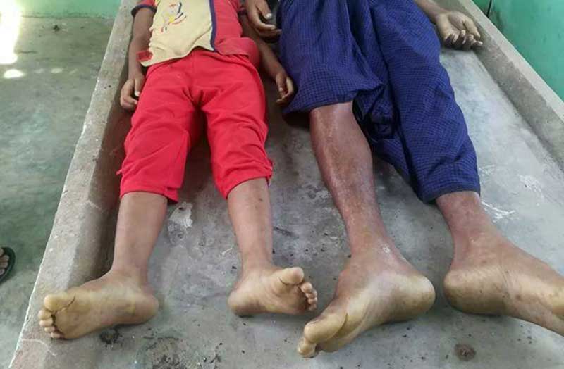 ဂြၿမိဳ႕နယ္​တြင္​ ငါးပူးတင္​းစားမိ၍ သားအဖသုံး​ဦး ေသဆုံး
