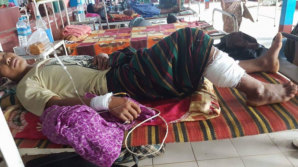 နန္းစီပြန္ေက်းရြာ ပစ္ခတ္မႈတြင္ ဒဏ္ရာရသူမ်ား ခႏၱီးေဆးရုံကုိေရာက္လာ (သတင္းဓာတ္ပံု)