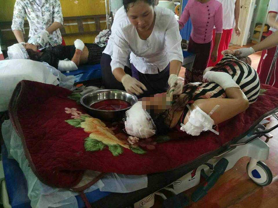 နမ့္ခမ္းတြင္ အလုပ္သမားမွ ဆိုင္ရွင္ကိုဓားျဖင့္ခုတ္၊ ၂ ဦးဒဏ္ရာရ