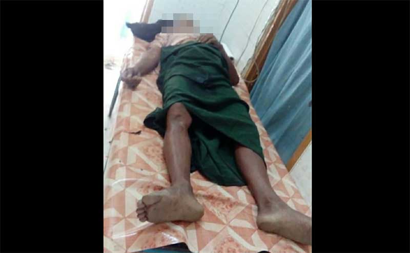 ဇနီးအိမ္ေပၚကဆင္းသြားသျဖင့္ ခင္ပြန္းျဖစ္သူ အဆိပ္ေသာက္သတ္ေသ