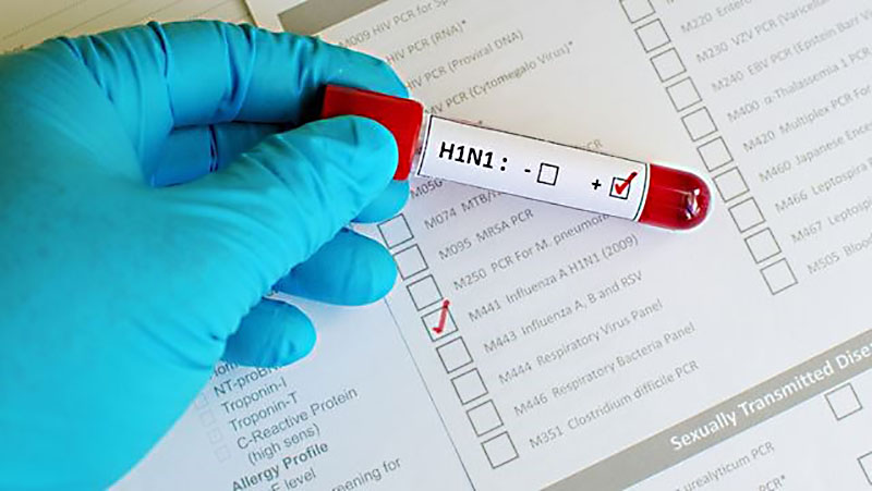 ျမန္မာႏုိင္ငံတြင္ H1N1 တုပ္ေကြးေရာဂါ သံသယရွိ လူနာ ၁၃ ဦး ေတြ႔ရွိ၊ ၁ ဦးေသ