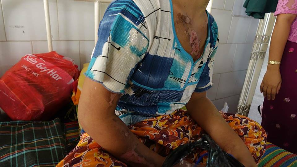 အိမ္အကူမိန္းကေလးကို ညႇဥ္းပန္းႏွိပ္စက္မႈ ဒဂံုဆိပ္ကမ္းတရား႐ုံးစတင္စစ္ေဆး