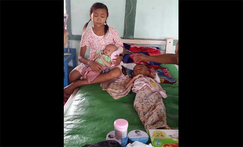 ေဆးစြဲမိဘေၾကာင့္ အာဟာရျပတ္ေနသည့္ ကေလး ၄ ဦးထဲက ၁ ဦး ထပ္မံေသဆုံး