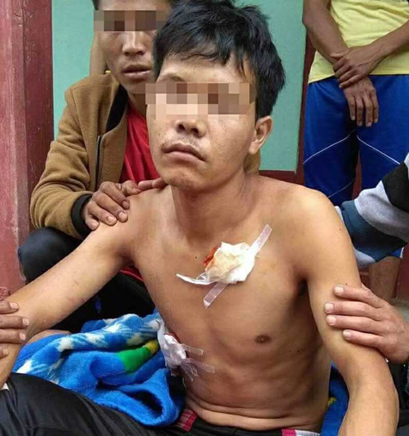 နမ့္ခမ္းတြင္ ျမန္မာ့တပ္မေတာ္ႏွင့္ တီအန္အယ္လ္ေအ တုိက္ပြဲျဖစ္၊ ရြာသား ၄ ဦး ဒဏ္ရာရ