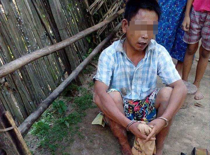 ရြာသားတဦးကို ေျခက်ိဳးေအာင္႐ုိက္ႏွက္သည့္ ရဲဝန္ထမ္း ၂ ဦးအား အမႈဖြင့္