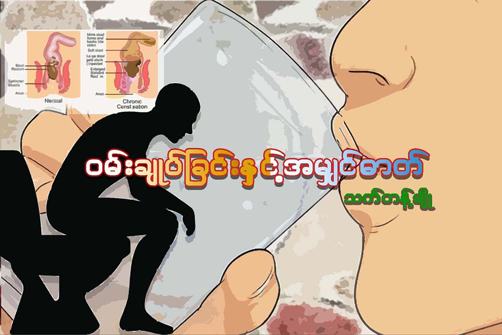 ဝမ္းခ်ဳပ္ျခင္းႏွင့္ အမွ်င္ဓာတ္