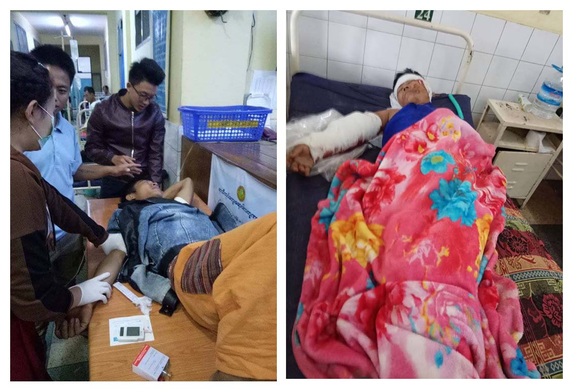 လား႐ိႈးတြင္ ဘုရားပြဲသြားယာဥ္တိမ္းေမွာက္၊ ၁ ဦးေသ ၂၂ ဦး ဒဏ္ရာရ