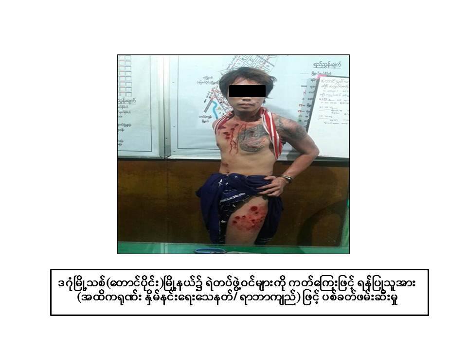 ရဲတပ္ဖြဲ႔၀င္မ်ားကို ကတ္ေၾကးျဖင့္ ရန္ရွာသူအား ပစ္ခတ္ဖမ္းဆီး