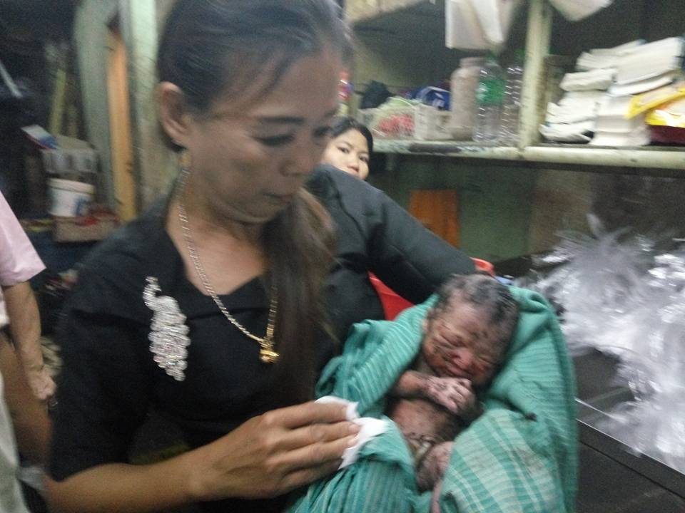 ရန္ကုန္ၿမိဳ႕လယ္တြင္ ေနာက္ေဖးလမ္းၾကားထဲပစ္ထားသည့္ ေမြးကင္းစကေလးေတြ႔ရွိ