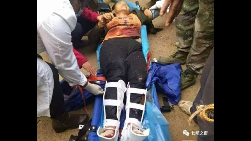 မံုးကိုးတြင္ ရြာသူတဦး ေဈးသြားရင္း မိုင္းနင္းမိၿပီး ေသဆံုး