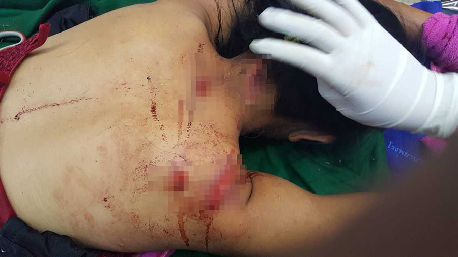 ျမန္မာလုပ္သားတဦး စိတ္မႏွံ႔သည့္ အမ်ိဳးသမီးကို မုဒိမ္းက်င့္ရန္ႀကံစည္မႈျဖင့္ အဖမ္းခံရ
