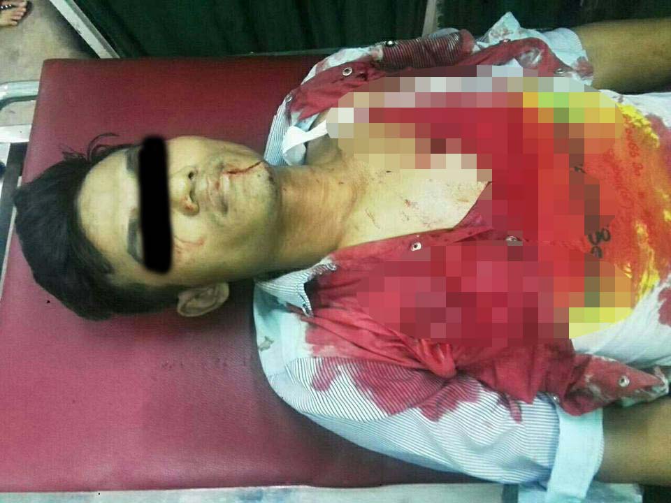 သမီးရည္းစား ခ်ိန္းေတြ႔စဥ္ လုယက္ ဓားထိုးခံရ၊ ၁ ဦး ေသဆံုး