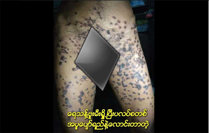 ေဖာက္ထြင္းမႈသံသယရွိသူအားႏွိပ္စက္ခဲ့သည့္ ရဲစခန္းမႉးအပါအဝင္ရဲ ၄ ဦးကို ဖမ္းဆီး