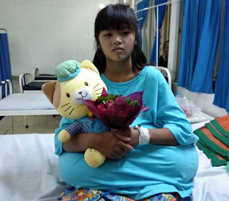 ရင္သားအဆမတန္ႀကီးထြားသည့္ ရွမ္းမိန္းကေလးငယ္ ခြဲစိတ္ကုသမႈစတင္ခံယူ