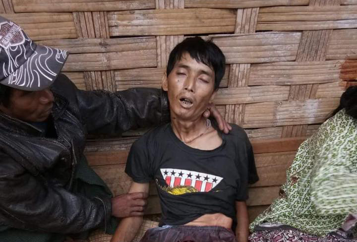 ဖားကန္႔တြင္ လက္နက္ႀကီးက်ည္က်၍ ရြာသား ၁ ဦး ေသဆုံး၊ ၁ ဦးဒဏ္ရာရ
