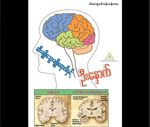 ဆီးခ်ိဳေသြးခ်ိဳေရာဂါႏွင့္ ဦးေႏွာက္