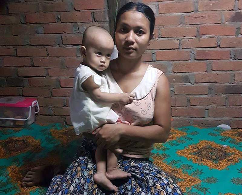 မအဂၤါ ၂ ခု၊ စအုိ ၂ ခုျဖင့္ ေမြးလာသည့္ ကေလးငယ္ ေဆးကုသရန္ ေငြေၾကးအခက္ႀကံဳ