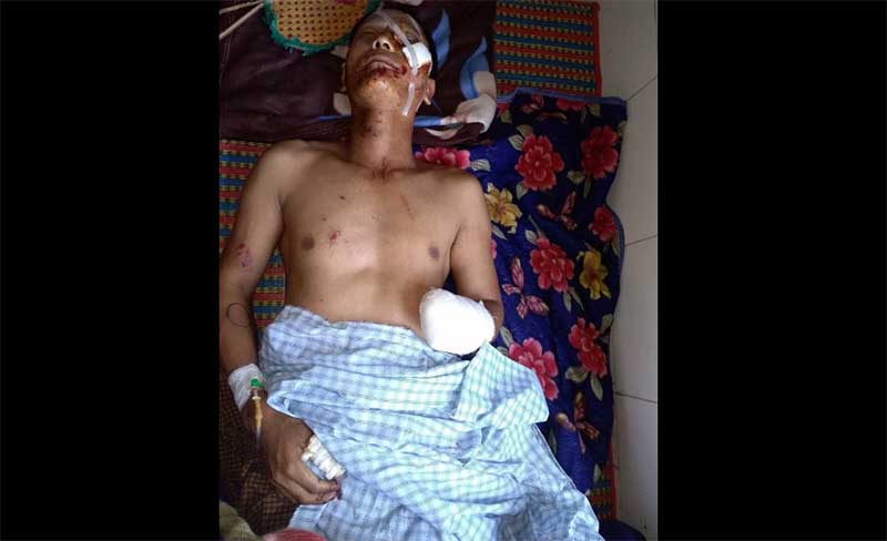 အားသြင္းစဥ္ဖုန္းသံုးမိ၍ ေပါက္ကြဲၿပီး အန္အယ္လ္ဒီ ပူတာအိုခ႐ိုင္ဥကၠ႒ဒဏ္ရာရ