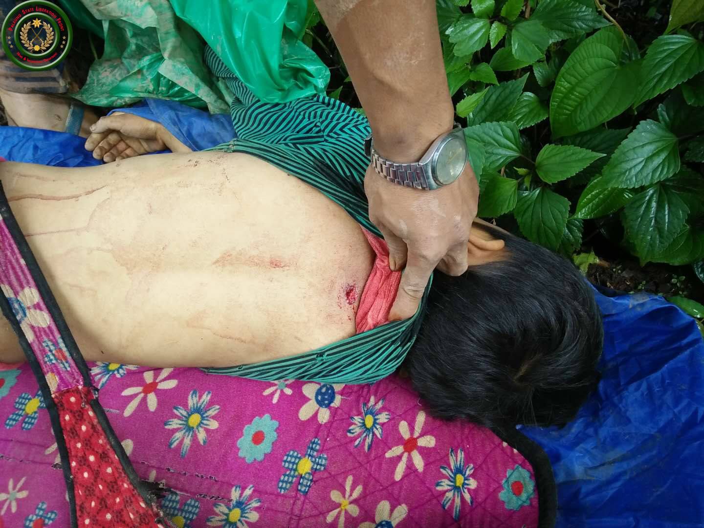 ကြတ္ခိုင္ၿမဳိ႕နယ္တြင္ လက္နက္ႀကီးက်ည္ေပါက္ကြဲ၍ ကေလး ၁ ဦးေသ၊ ၇ ဦးဒဏ္ရာရ