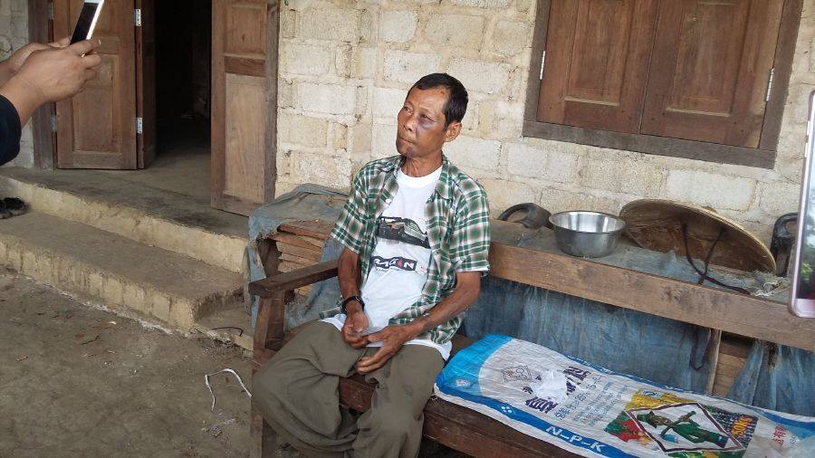 နမၼတူၿမိဳ႕နယ္တြင္ ရြာသား ၁ ဦးကို ပေလာင္တပ္ဖြဲ႔က ႐ိုက္ႏွက္မႈျဖစ္ပြား