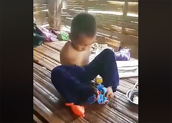 လက္ႏွစ္ဖက္မပါေပမယ့္ စက္ဘီးစီးကၽြမ္းက်င္သည့္ ကေလးငယ္ ေဆးကုရန္ အကူအညီလိုေန
