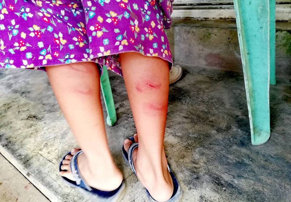 မင္းျပားတြင္ ဆရာမတဦး ႐ုိက္ႏွက္မႈေၾကာင့္ ေက်ာင္းသား၂၀ ေက်ာ္ ဒဏ္ရာရ