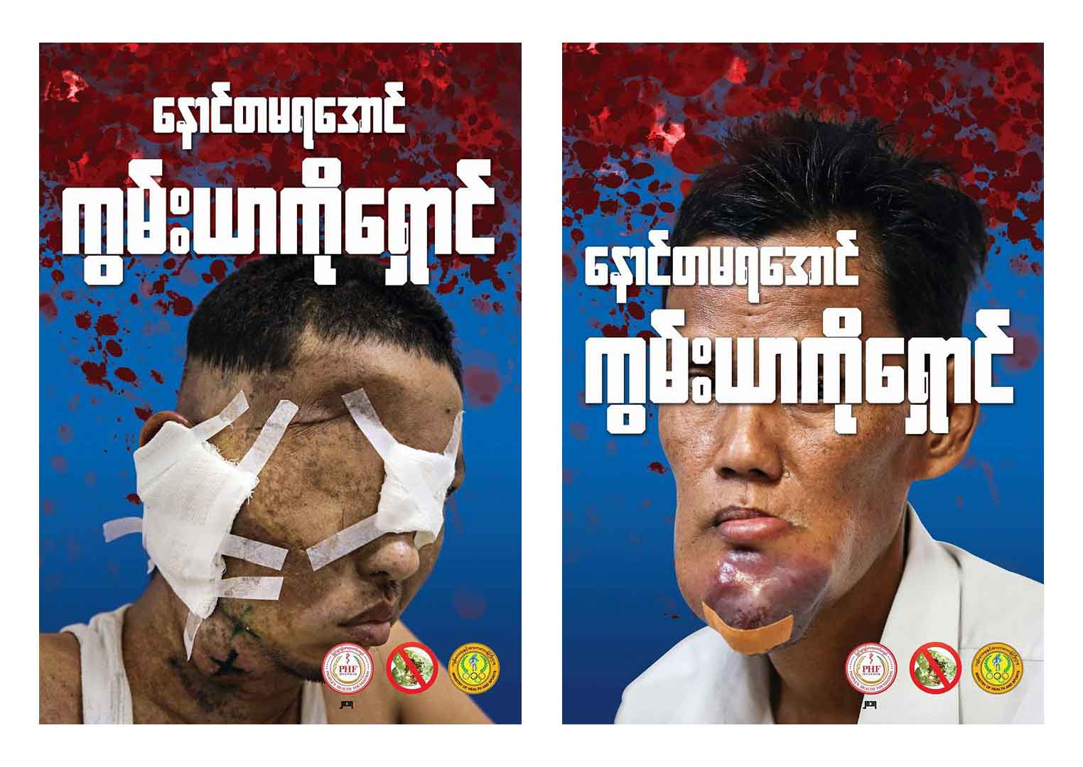 ကြမ္းယာ၊ ေဆးလိပ္ႏွင့္ ေဆး႐ြက္ႀကီးထြက္ ပစၥည္းမ်ိဳးစုံ သုံးစြဲမႈေၾကာင့္ ႏွစ္စဥ္ေသဆုံးသူ ၆၅၀၀၀ ခန္႔ရွိ