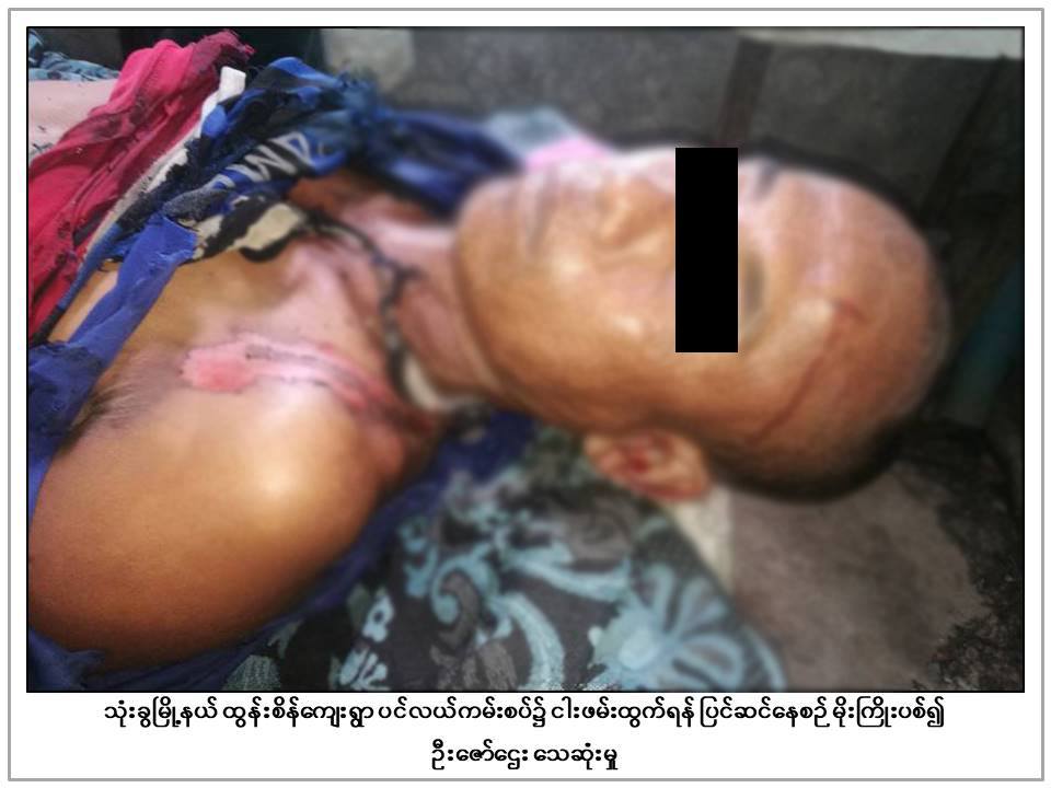 ရန္ကုန္တိုင္းေဒသႀကီးအတြင္း မုိးႀကိဳးပစ္သျဖင့္ လူ ၂ ဦးေသဆုံး